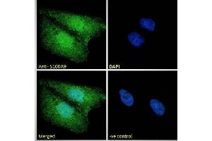 Immunofluorescence (IF) image for anti-S100 Calcium Binding Protein A9 (S100A9) (Internal Region) antibody (ABIN335161)