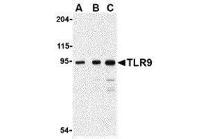 Western Blotting (WB) image for anti-Toll-Like Receptor 9 (TLR9) (Center) antibody (ABIN2479768) (TLR9 抗体  (Center))