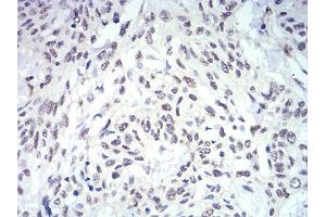Immunohistochemistry (IHC) image for anti-Interleukin 28A (Interferon, lambda 2) (IL28A) (AA 1-200) antibody (ABIN5542627)