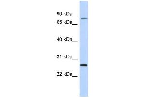 WB Suggested Anti-ZSCAN2 Antibody Titration:  0. (ZSCAN2 抗体  (Middle Region))