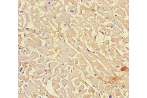 Immunohistochemistry of paraffin-embedded human heart tissue using ABIN7157632 at dilution of 1:100 (KIF24 抗体  (AA 1168-1368))