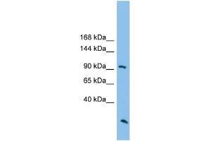 WB Suggested Anti-ARHGAP30 Antibody Titration: 0. (ARHGAP30 抗体  (N-Term))