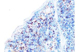 Immunohistochemistry of paraffin-embedded mouse spleen using Arp3 Rabbit mAb (ABIN7265676) at dilution of 1:100 (40x lens). (ACTR3 抗体)