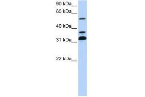 WB Suggested Anti-TRIM9 Antibody Titration:  0. (TRIM9 抗体  (C-Term))