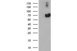 HEK293T cells were transfected with the pCMV6-ENTRY control (Left lane) or pCMV6-ENTRY AFP (Right lane) cDNA for 48 hrs and lysed. (alpha Fetoprotein 抗体)