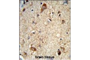 Formalin-fixed and paraffin-embedded human brain tissue reacted with DAB1 Antibody (Center), which was peroxidase-conjugated to the secondary antibody, followed by DAB staining. (DAB1 抗体  (AA 189-216))