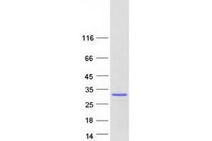 Western Blotting (WB) image for TGFB-Induced Factor Homeobox 2-Like, Y-Linked (TGIF2LY) protein (Myc-DYKDDDDK Tag) (ABIN2733537)