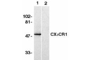 Western blot analysis of CX3CR1 in human spleen lysate with AP30264PU-N CX3CR1 antibody in the absence (lane 1) or presence of blocking peptide (lane 2). (CX3CR1 抗体  (N-Term))