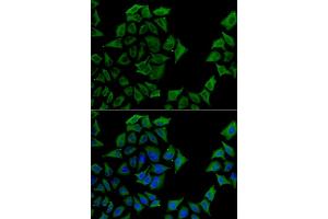Immunofluorescence analysis of U2OS cell using TCN1 antibody. (TCN1 抗体)