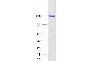 Western Blotting (WB) image for Pyruvate Carboxylase (PC) (Transcript Variant 3) protein (Myc-DYKDDDDK Tag) (ABIN2730237)