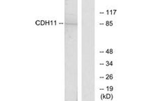 Western blot analysis of extracts from Jurkat cells, using CDH11 Antibody. (OB Cadherin 抗体  (AA 421-470))