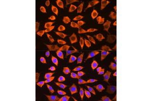 Immunofluorescence analysis of L929 cells using RPS3 antibody (ABIN3023342, ABIN3023343, ABIN3023344 and ABIN6219623) at dilution of 1:100.