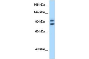 WB Suggested Anti-ZHX1 Antibody Titration: 1. (ZHX1 抗体  (N-Term))