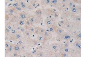 Detection of DDX58 in Human Liver Tissue using Polyclonal Antibody to Probable ATP-dependent RNA Helicase DDX58 (DDX58) (DDX58 抗体  (AA 550-776))