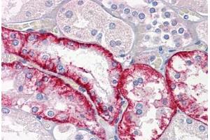 Human Kidney: Formalin-Fixed, Paraffin-Embedded (FFPE) (Cathepsin K 抗体  (AA 220-331))