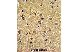 Immunohistochemistry (Paraffin-embedded Sections) (IHC (p)) image for anti-Regulator of Chromosome Condensation (RCC1) and BTB (POZ) Domain Containing Protein 2 (RCBTB2) (AA 71-99), (N-Term) antibody (ABIN390702)