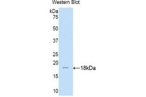 Western blot analysis of the recombinant protein. (IL17RA 抗体  (AA 33-172))