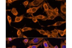 Immunofluorescence analysis of HeLa cells using USP36 Polyclonal Antibody at dilution of 1:100 (40x lens). (USP36 抗体)