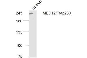 Mouse spleen lysates probed with MED12/Trap230 Polyclonal Antibody, Unconjugated  at 1:300 dilution and 4˚C overnight incubation. (MED12 抗体  (AA 251-350))