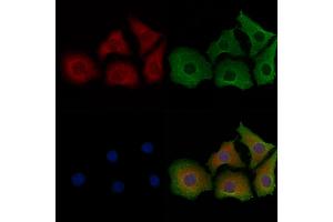 ABIN6261881, ABIN6267053, ABIN6267054 and ABIN6267055 staining Hela cells by IF/ICC. (GAPDH 抗体)