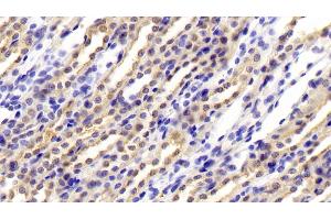 Detection of CFB in Rat Kidney Tissue using Polyclonal Antibody to Complement Factor B (CFB) (Complement Factor B 抗体  (AA 34-159))