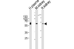 Western blot analysis of lysates from human plasma, mouse kidney, rat kidney tissue lysate (from left to right), using CNDP1 Antibody (Center) (ABIN6243352 and ABIN6577403). (CNDP1 抗体  (AA 128-142))