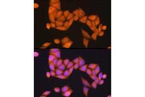 Immunofluorescence analysis of HeLa cells using Rap1B Rabbit pAb (ABIN6132985, ABIN6146685, ABIN6146686 and ABIN6216738) at dilution of 1:100 (40x lens). (RAP1B 抗体  (AA 1-184))