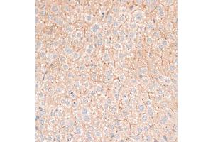 Immunohistochemistry of paraffin-embedded mouse liver using CDH18 antibody (ABIN6291131) at dilution of 1:100 (40x lens). (CDH18 抗体)