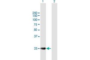 Western Blot analysis of TERF2 expression in transfected 293T cell line by TERF2 MaxPab polyclonal antibody. (TRF2 抗体  (AA 1-251))