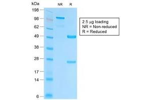 SDS-PAGE (SDS) image for anti-Epithelial Cell Adhesion Molecule (EPCAM) (AA 100-224), (Extracellular Domain) antibody (ABIN5707556)