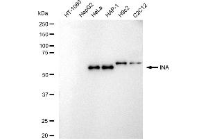 Western blotting analysis using INA antibody (ABIN7799117).