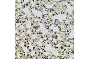 Immunohistochemistry of paraffin-embedded mouse lung using POT1 antibody. (POT1 抗体)
