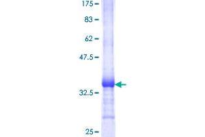 Image no. 1 for Prostate Stem Cell Antigen (PSCA) (AA 23-95) protein (GST tag) (ABIN1316512)