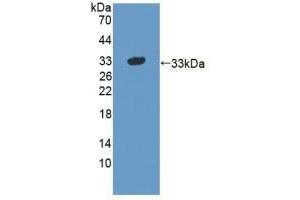 Detection of Recombinant STX1A, Human using Polyclonal Antibody to Syntaxin 1A, Brain (STX1A) (STX1A 抗体  (AA 1-255))