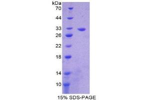 SDS-PAGE (SDS) image for Citrate Synthase (CS) (AA 56-312) protein (His tag) (ABIN2124349) (CS Protein (AA 56-312) (His tag))