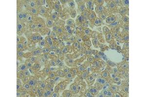 Used in DAB staining on fromalin fixed paraffin- embedded liver tissue (IL1RAP 抗体  (AA 21-367))