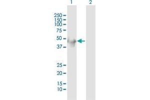 Western Blot analysis of KRT34 expression in transfected 293T cell line by KRT34 MaxPab polyclonal antibody. (Keratin 34 抗体  (AA 1-436))