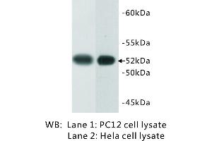 Image no. 1 for anti-Tubulin B antibody (ABIN1112941) (Tubulin B 抗体)