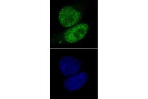 SMARCA4 antibody (mAb) (Clone 5B7) tested by immunofluorescence. (SMARCA4 抗体  (AA 213-295))