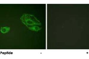 Immunofluorescence analysis of A-549 cells, using ERBB3 polyclonal antibody . (ERBB3 抗体)