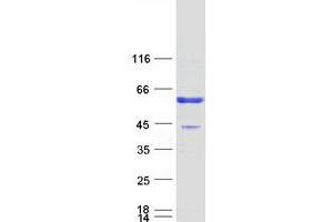 Validation with Western Blot (CA14 Protein (Myc-DYKDDDDK Tag))