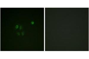 Immunofluorescence analysis of A549 cells, using Chk1 (Ab-301) Antibody. (CHEK1 抗体  (AA 271-320))
