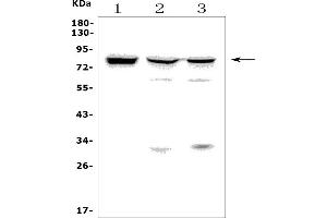 Western blot analysis of MASP2 using anti-MASP2 antibody (ABIN7602762).