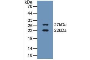 Detection of Recombinant CIRBP, Human using Polyclonal Antibody to Cold Inducible RNA Binding Protein (CIRBP) (CIRBP 抗体  (AA 1-172))