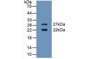 CIRBP Antikörper  (AA 1-172)