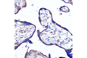 Immunohistochemistry of paraffin-embedded human placenta using JAM-A/CD321/F11R Rabbit pAb (ABIN3021822, ABIN3021823, ABIN3021824, ABIN1512881 and ABIN6216028) at dilution of 1:100 (40x lens). (F11R 抗体  (AA 30-238))
