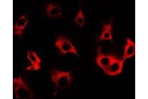 Immunofluorescent analysis of Cullin 5 staining in SW480 cells. (Cullin 5 抗体)