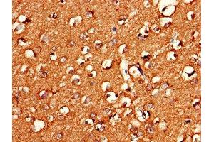 Immunohistochemistry of paraffin-embedded human brain tissue using ABIN7154668 at dilution of 1:100 (GNG11 抗体  (AA 1-70))