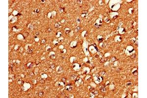 Immunohistochemistry (IHC) image for anti-Guanine Nucleotide Binding Protein (G Protein), gamma 11 (GNG11) (AA 1-70) antibody (ABIN7154668)