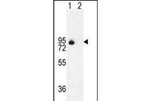 Western blot analysis of ENG (arrow) using rabbit polyclonal ENG Antibody (Center) (ABIN655186 and ABIN2844801). (Endoglin 抗体  (AA 265-294))